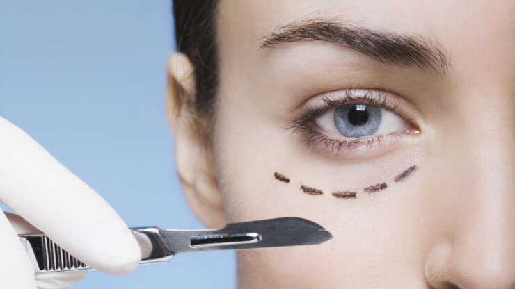 Blepharoplasty, the operation that will change your look
